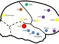 Research and theories on Tinnitus